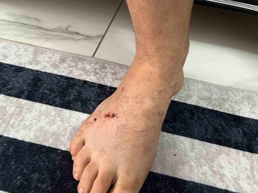 Köpek Dehşetinin Mağduru Motokurye O Anları Anlattı: "köpek Kafasını Çırpabilseydi Etimi Koparabilirdi"