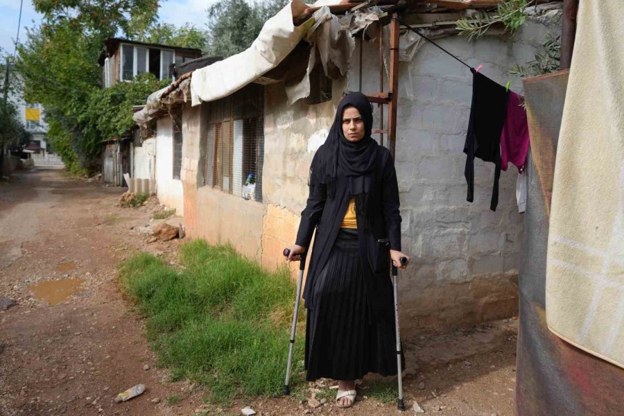 Kahramanmaraş Merkezli Büyük Depremde Bacağını Kaybetti, Eşi Terk Etti