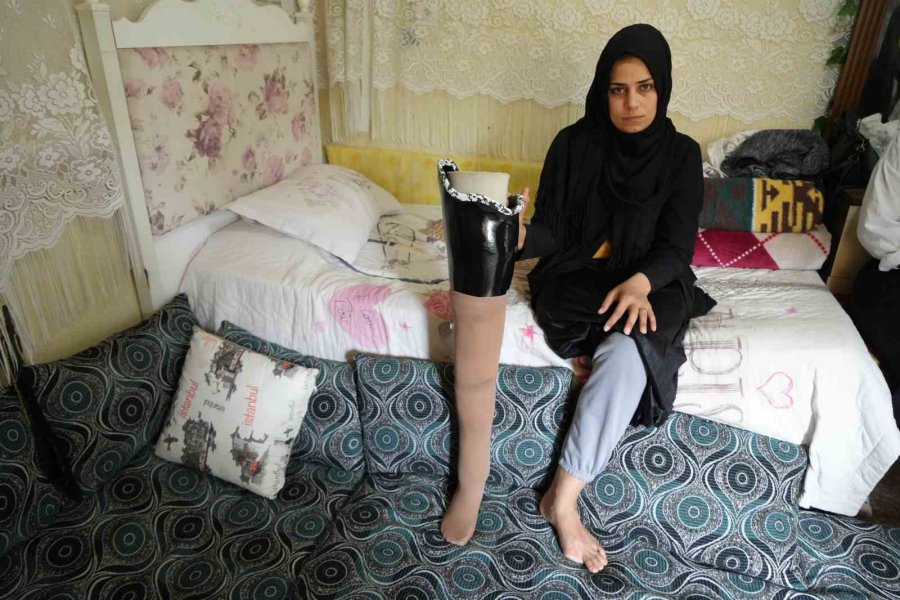 Kahramanmaraş Merkezli Büyük Depremde Bacağını Kaybetti, Eşi Terk Etti