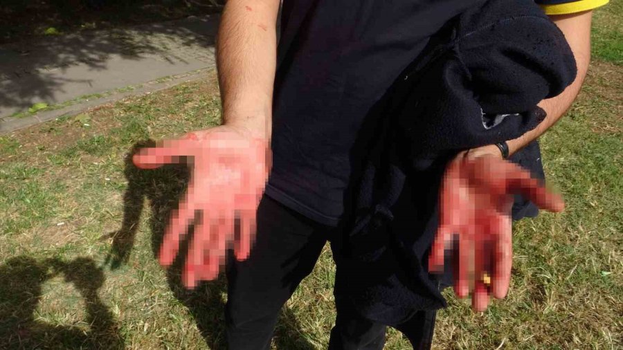 Eline Aldığı Bıçakla Yoldan Geçenlere Dehşeti Yaşattı: 1 Yaralı