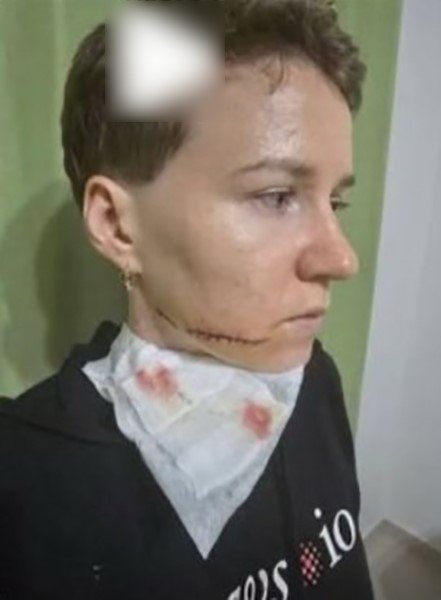 Alanya’da Sokakta Kadına Saldırıda Bulunan Şahıs Adliyeye Sevk Edildi