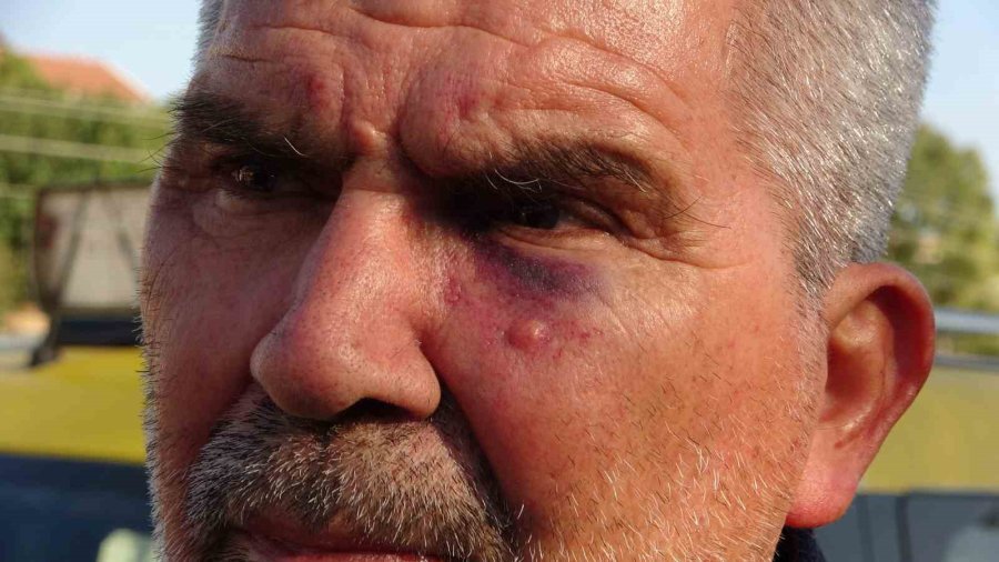 Mersin’de 62 Yaşındaki Taksiciyi Bıçaklayıp Darp Ettiler