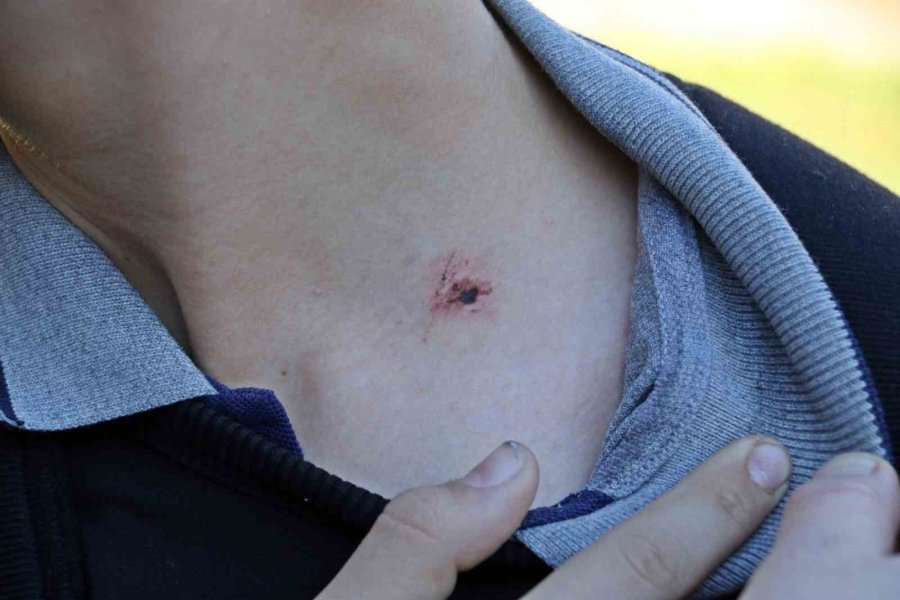 Antalya’da 7’nci Sınıf Öğrencisine Akran Zorbalığı İddiası