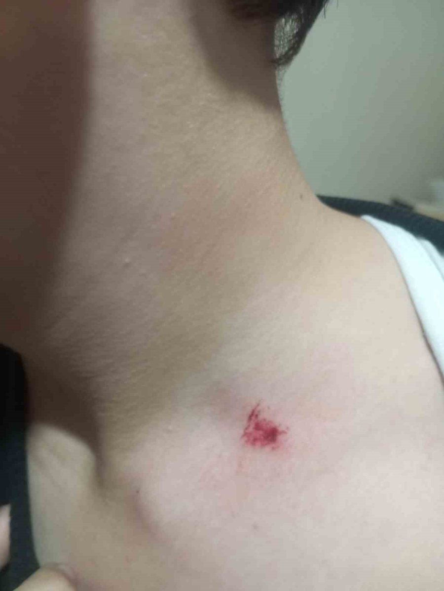 Antalya’da 7’nci Sınıf Öğrencisine Akran Zorbalığı İddiası