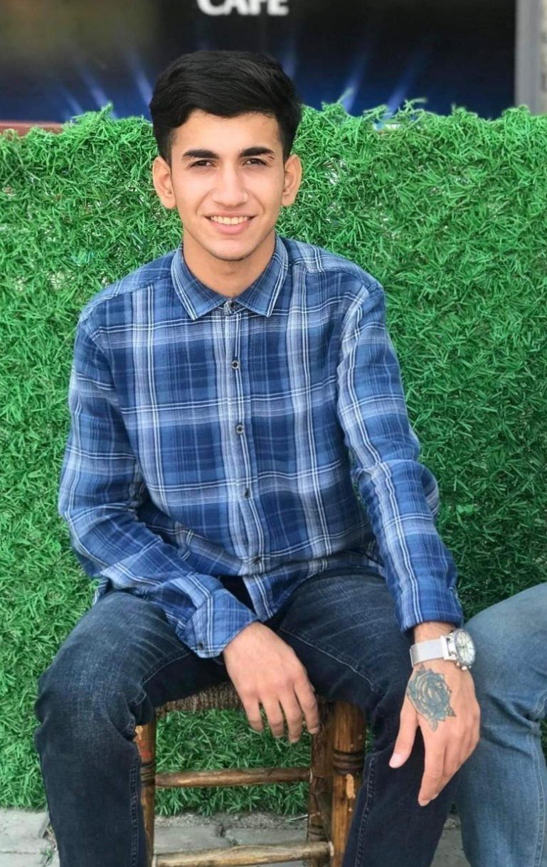 Dövme Sildirmek İsterken Kabusu Yaşadı, Elindeki Dokular Öldü