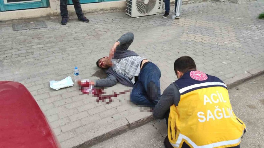 Aksaray’da İki Kardeş Tartıştıkları Genci Bıçakla Yaralayıp Kaçtı