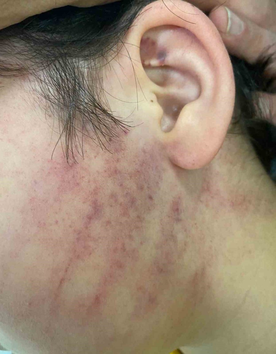 İlkokul Öğrencilerinin Sıra Tartışmasında Okula Gelen Baba, Anne Ve Babaanne 2 Çocuğu Darp Etti