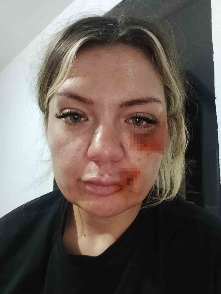 Eski Sevgilisinin Elinden Kırılan Bıçakla Kurtuldu