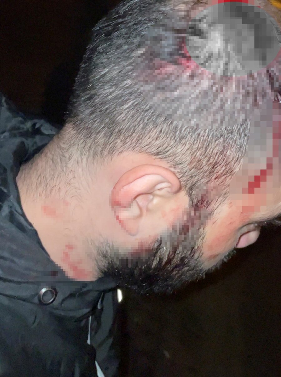 Motosikletli Gence Çarpıp Kask Kamerası Görüntülerinin Silindiği İddiası
