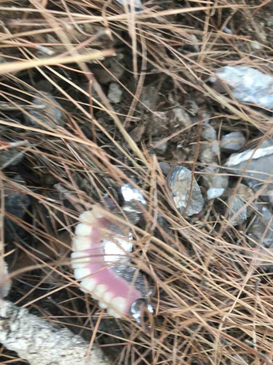 Mevlide Gitmek İçin Çıkıp 15 Aydır Kayıp Olarak Aranan Yaşlı Adam Olayında Kafatasından Sonra Takma Diş Detayı